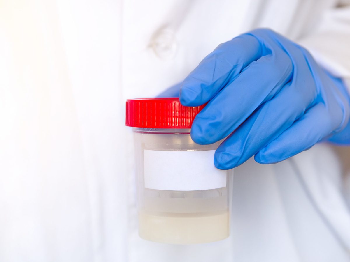 1310 scaled 1 Tecnogenext